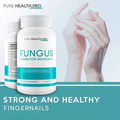 Fungus Eliminator Extreme – Skin & Nail Health Support – 60 Capsules