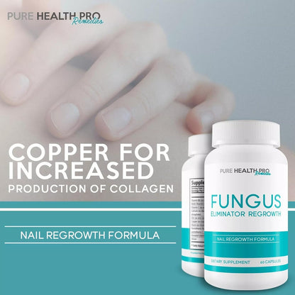 Fungus Eliminator Extreme – Skin & Nail Health Support – 60 Capsules