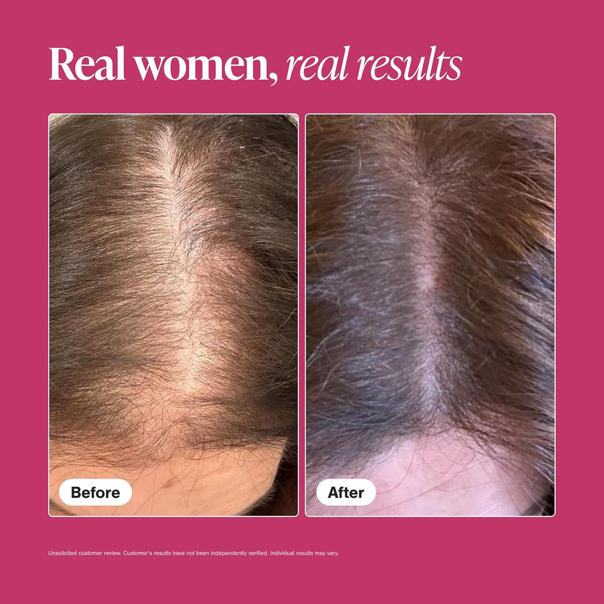 Viviscal Hair Growth Supplement for Women – 180 Tablets – 90-Day Supply