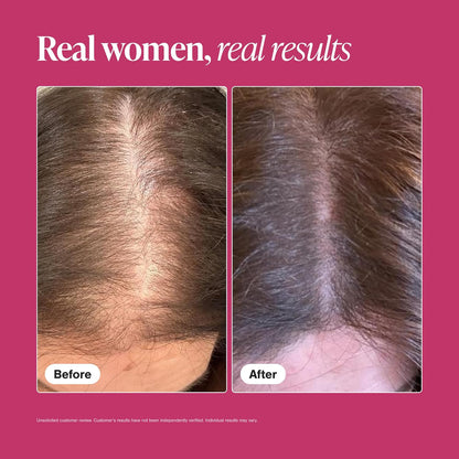 Viviscal Hair Growth Supplement for Women – 180 Tablets – 90-Day Supply