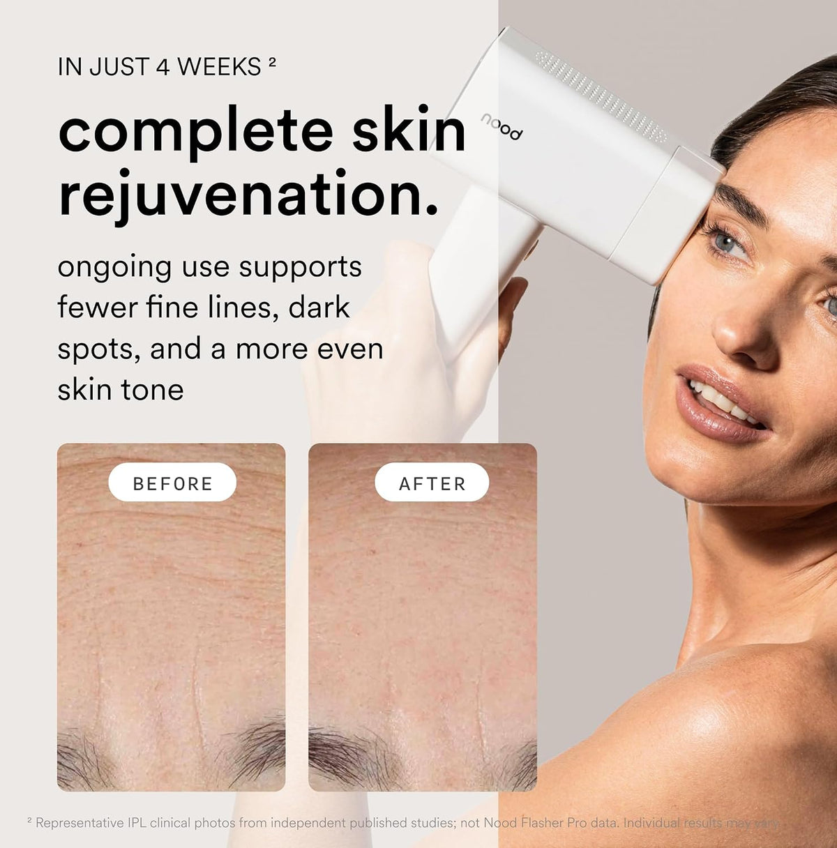 Nood™ Flasher Pro – IPL Laser Hair Removal Device – At-Home Hair Reduction