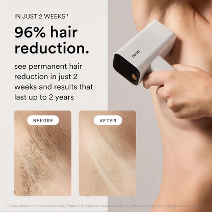Nood™ Flasher Pro – IPL Laser Hair Removal Device – At-Home Hair Reduction