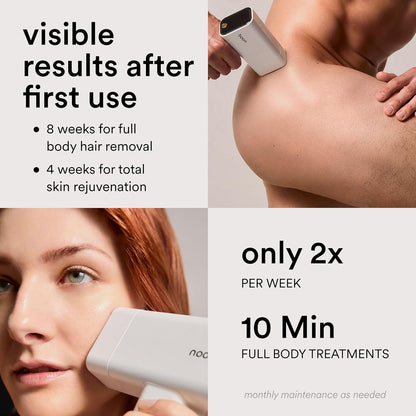Nood™ Flasher Pro – IPL Laser Hair Removal Device – At-Home Hair Reduction